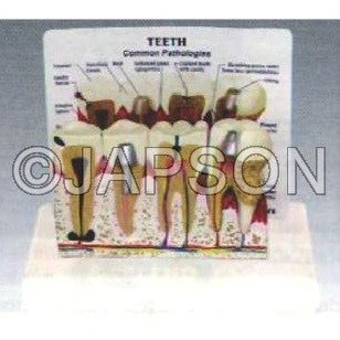 Teeth Model With Description Plate Teeth Model With Description Plate